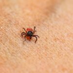 Preventing Skin Irritation