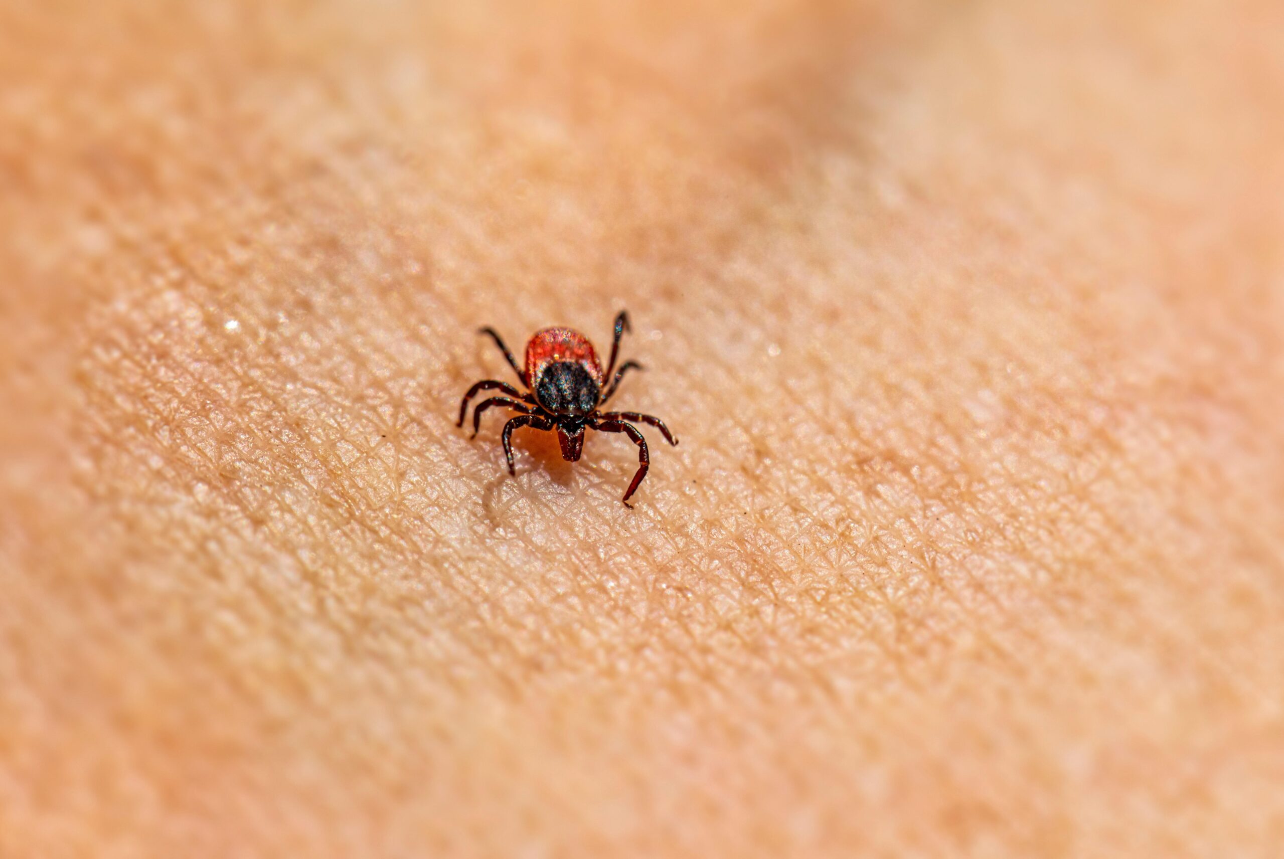 Preventing Skin Irritation